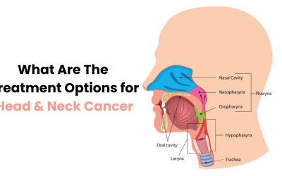 What Are The Treatment Options for Head & Neck Cancer?