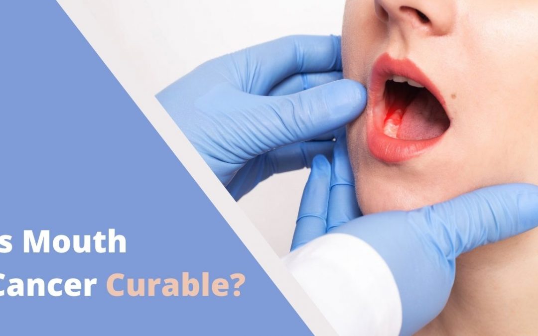 Is Mouth Cancer Curable