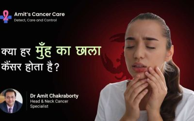 Is Every Ulcer in The Mouth is Cancerous?