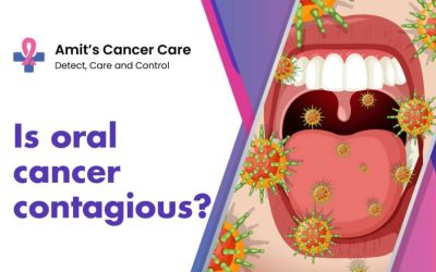 The Truth About Oral Cancer Contagion