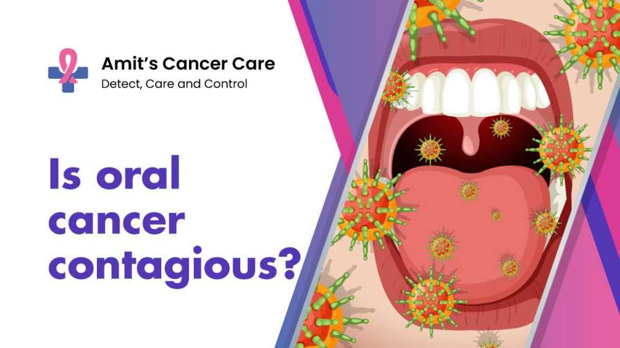 Is oral cancer contagious?