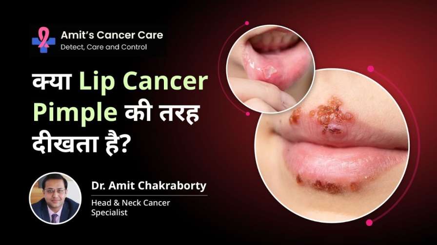 Cancerous Pimple on Lips