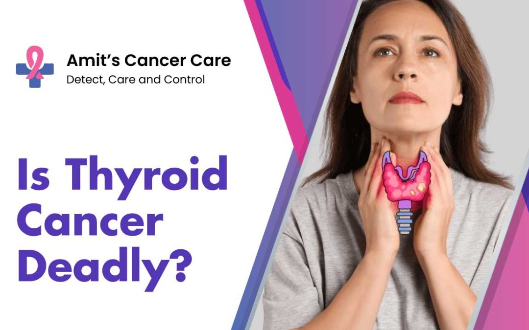 Is Thyroid Cancer Deadly?
