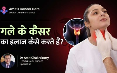 Throat Cancer Treatment