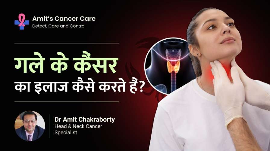 Throat Cancer Treatment