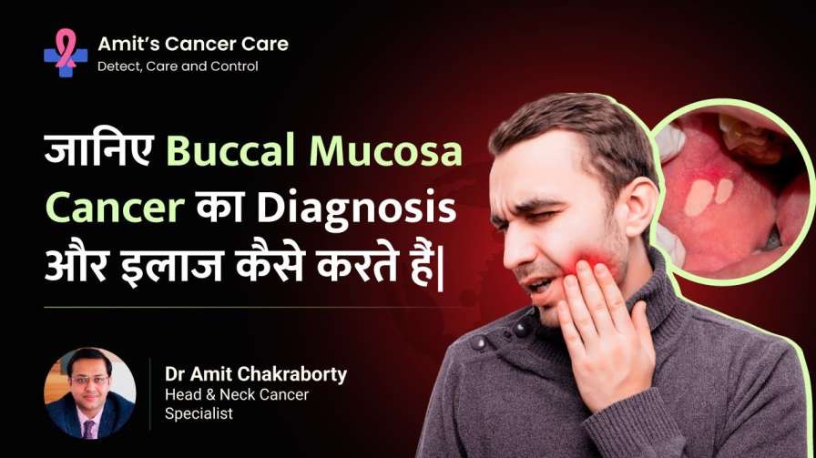 Buccal Mucosa Cancer: Diagnosis & Treatment