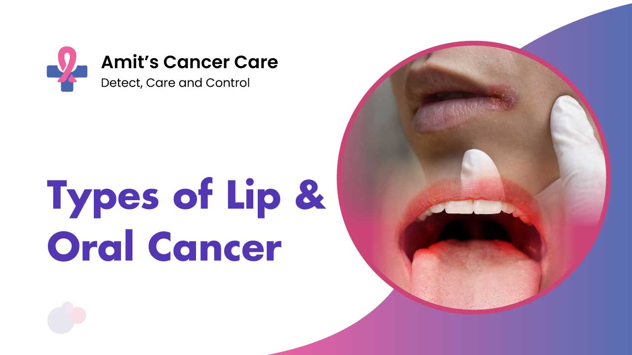 most common types of lip and oral cancers