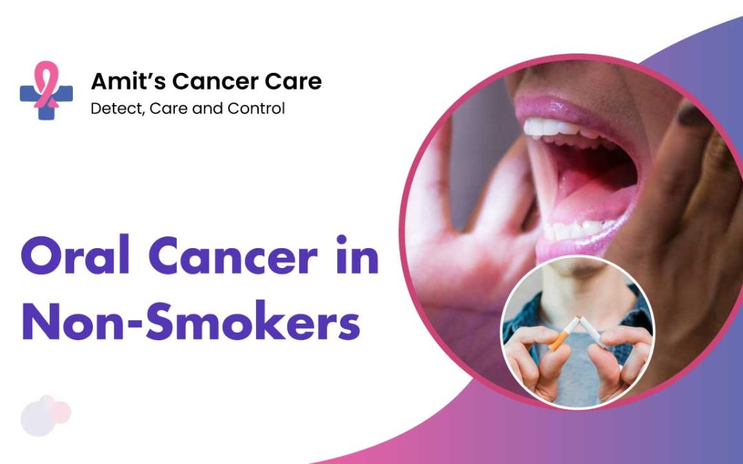 Oral cancer in non smokers