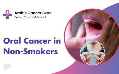 What Causes Mouth Cancer in a Non Smoker?