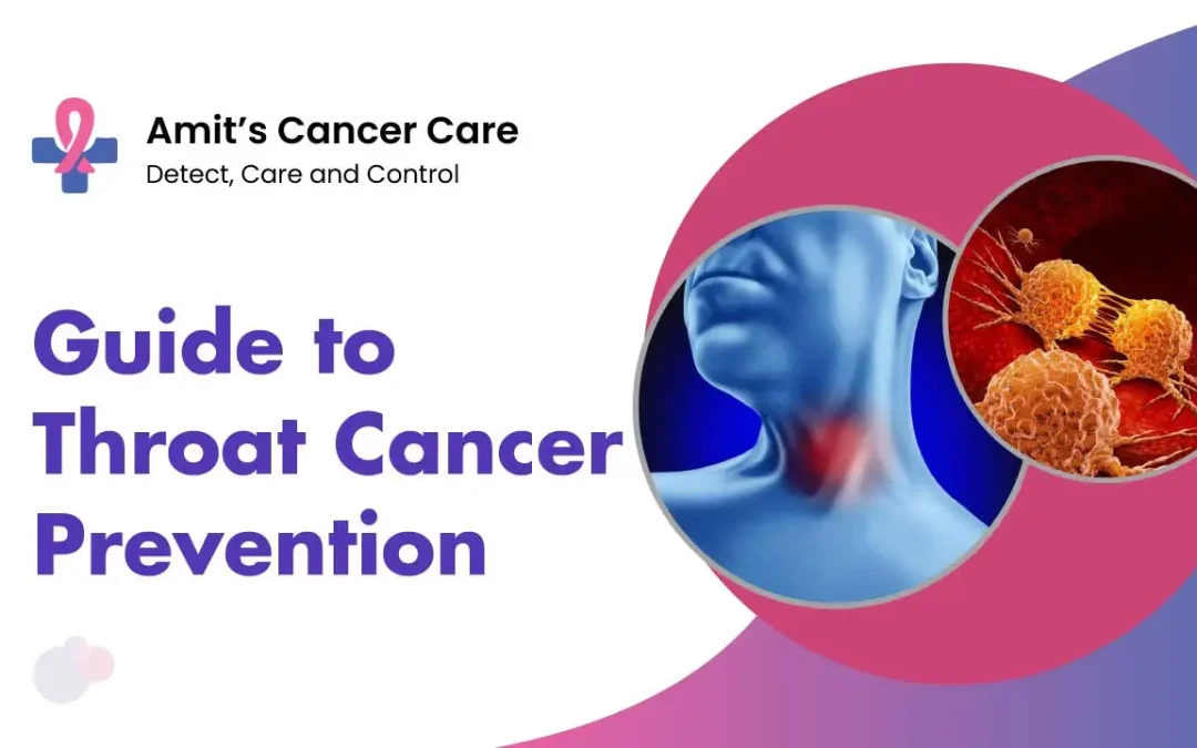Guide to Throat Cancer Prevention