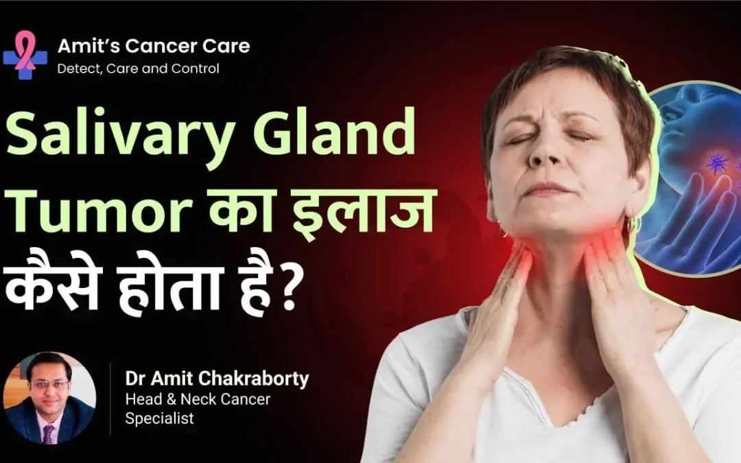 What are the Treatments for Salivary Gland Tumors?