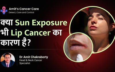 Can sun exposure cause cancer